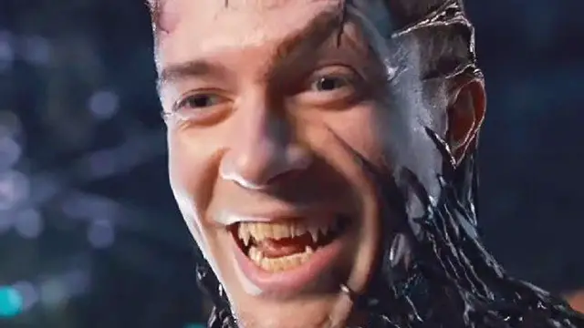 Video thumbnail for Actors Injured By Painful Costumes And Prosthetics