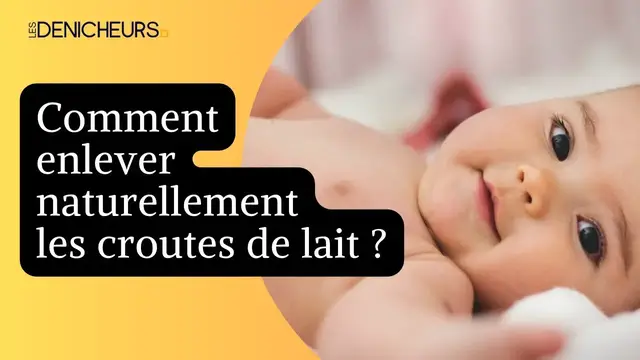 Video thumbnail for 🚼 Comment enlever naturellement les croutes de lait chez un bébé ?👶 🍼