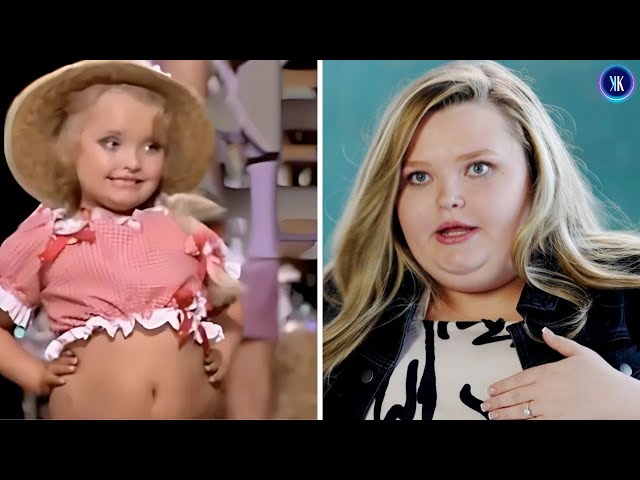 Video thumbnail for Alana Thompson Still Recovering From Her 'Honey Boo Boo' Nightmare