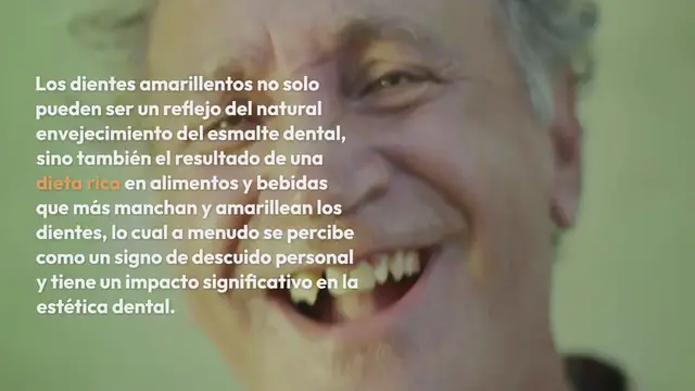 Video thumbnail for 10 alimentos que provocan dientes amarillentos