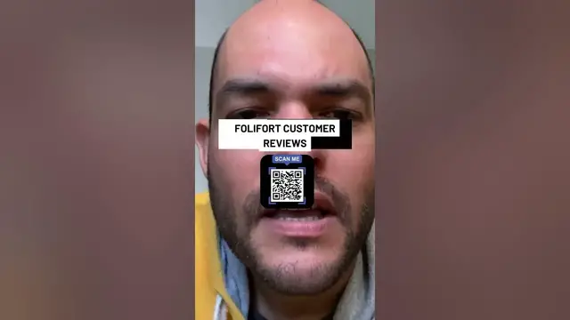 Video thumbnail for Folifort - Customer Review  - Does it Really Work?Real Hair Growth Results!