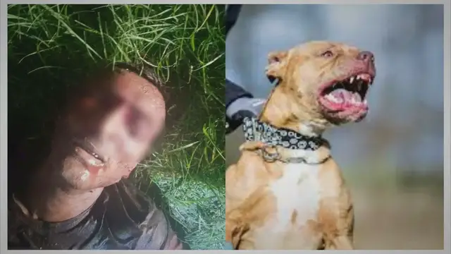'Video thumbnail for Man, 44, Loses Eyeball And Chunks Of Flash In Pitbull Attack'