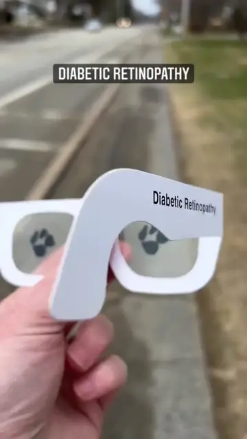 Video thumbnail for Simulation of Eye Problems