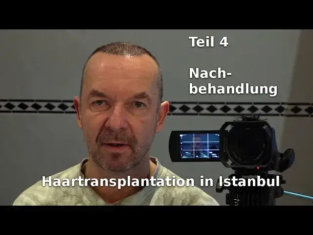 Video thumbnail for Haartransplantation in Istanbul (4) Nachbehandlung