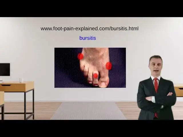 'Video thumbnail for bursitis of the foot'