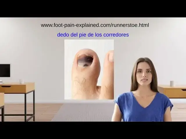 'Video thumbnail for dedo del pie de los corredoles'