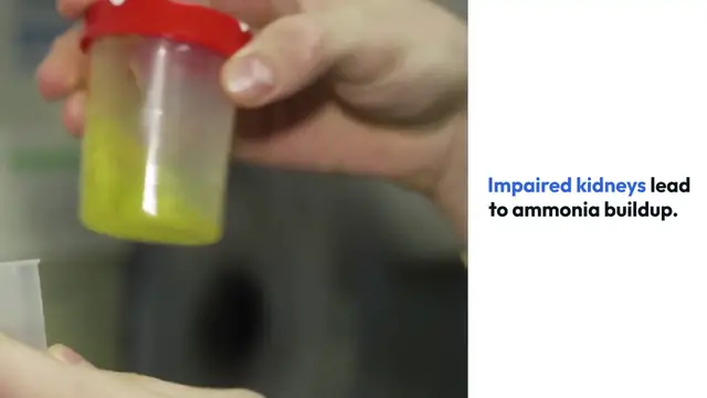 Video thumbnail for Signs_of_Toxic_Kidneys