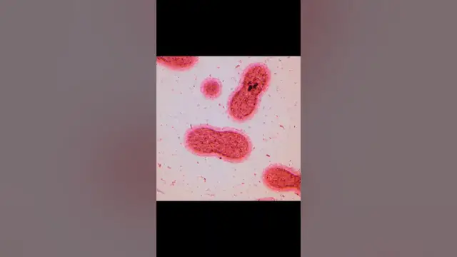 Video thumbnail for Liberando el potencial de una bacteria que come plástico