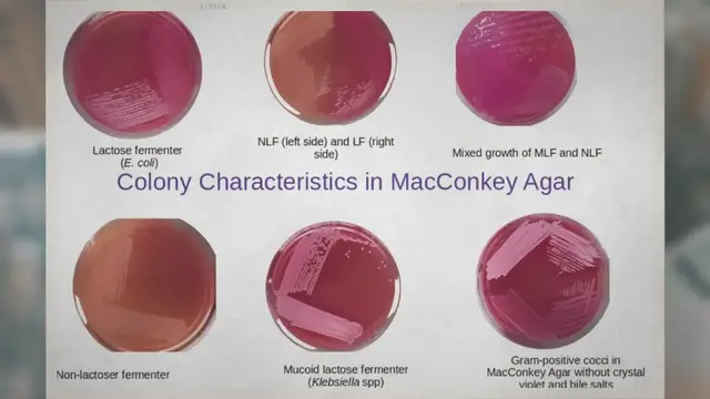 'Video thumbnail for MacConkey Agar: Composition, Uses, Colony Characteristics'