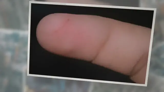 'Video thumbnail for How to Treat a Paper Cut, and How Long Before They Heal?'