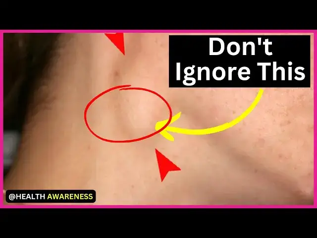 Video thumbnail for 20 Early Signs and Symptoms of HIV AIDS You Must Not Ignore