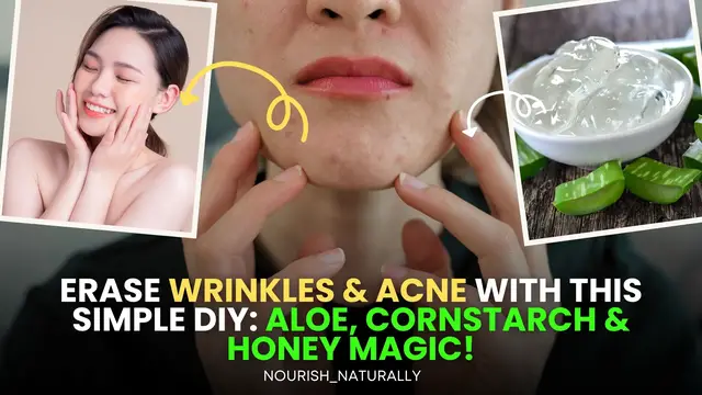 'Video thumbnail for Erase Wrinkles & Acne with THIS Simple DIY: Aloe, Cornstarch & Honey Magic!'