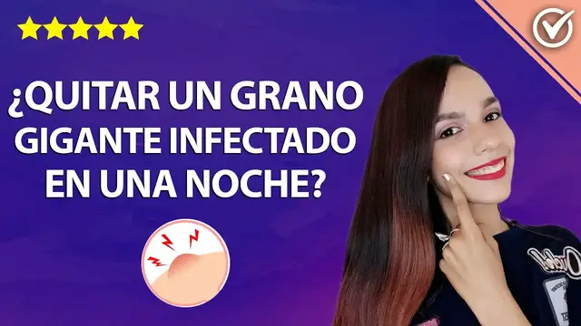 Video thumbnail for Cómo Eliminar o Quitar un Grano Gigante Infectado o Enquistado en una Noche - Debajo de un Lunar
