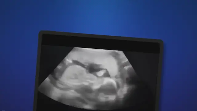 Video thumbnail for Dr. Oz on Abortion: Between a ‘Woman, Her Doctor, and Local Political Leaders’