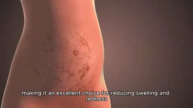 'Video thumbnail for Helichrysum Oil benefits'