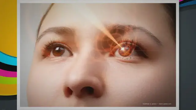 Video thumbnail for LaZrPlastique: LASIK without cutting the cornea - Eye Care