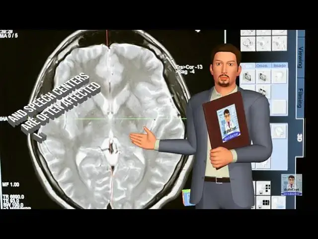 Video thumbnail for Brain tumours