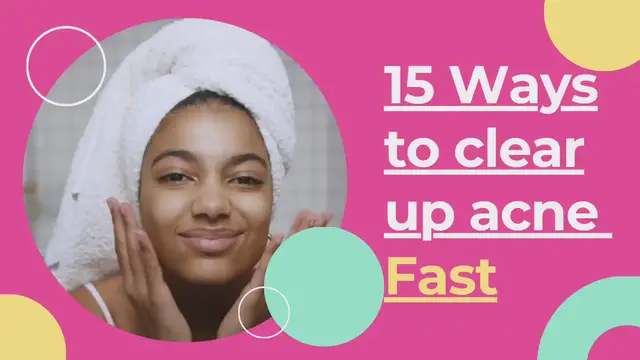 'Video thumbnail for 15 Ways to clear up acne fast'
