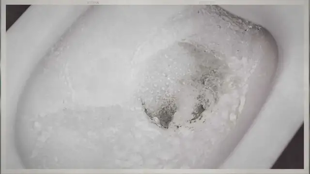 'Video thumbnail for Toilet Water Splashed on Me (Stop and Do This ASAP!)'