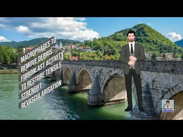 Video thumbnail for Short Medical Notes / Wound healing  / Medical Lecture / Medical Video / Medical Students