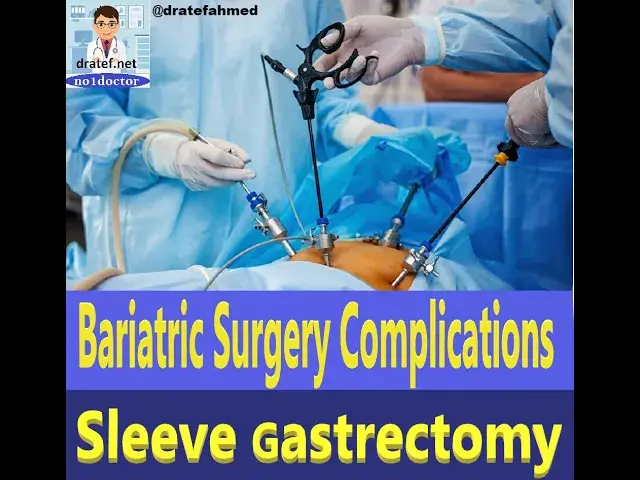 Video thumbnail for Bariatric Surgery Complications / Sleeve Gastrectomy Complications /Weight loss surgery /no1doctor