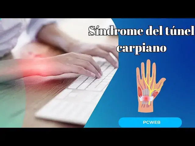 Video thumbnail for Prevenir el síndrome del túnel carpiano: estrategias efectivas y recomendaciones