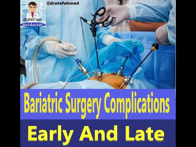 Video thumbnail for Bariatric Surgery Complications/ Early and late / Weight loss surgery / Sleeve Gastrectomy/Leakage
