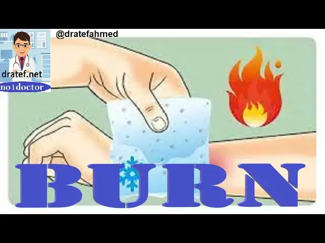 Video thumbnail for Burn / Medical lecture/Mrcs Qs/ Frcs QS /Usmle Qs/No1doctor/ Dratef/ Burn Managment/Medical Students