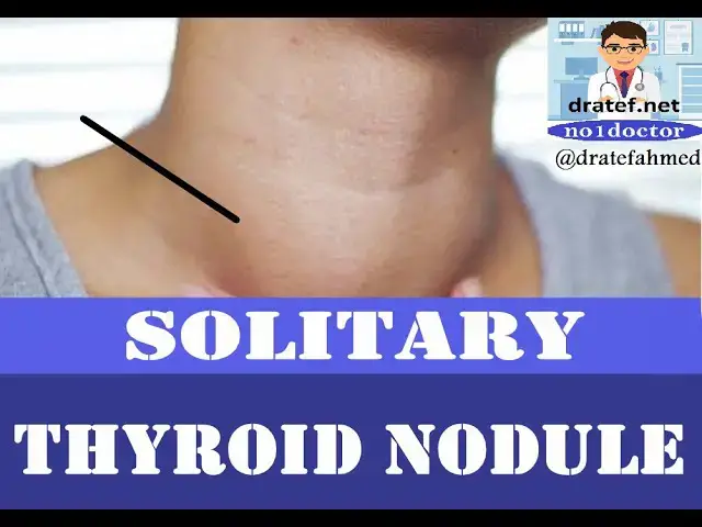 Video thumbnail for Solitary Thyroid Nodule/ Thyroid Nodules /Thyroid Cancer /Thyroid Imaging / Surgery For Thyroid