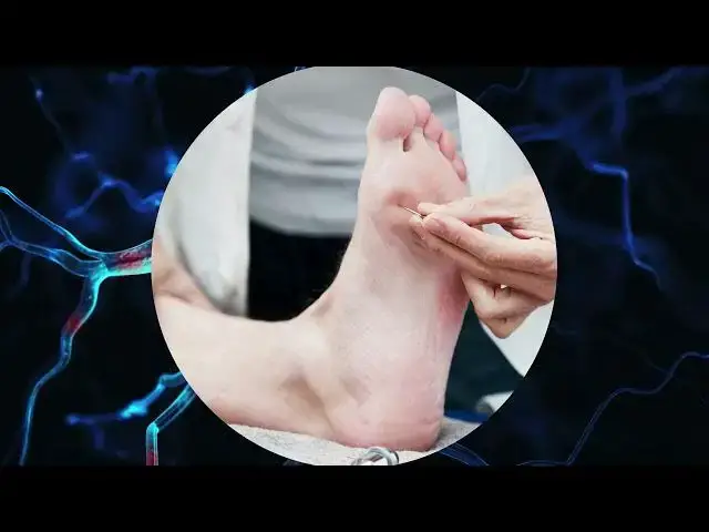 Video thumbnail for Neuropathy Pain Relief: How This Vitamin Can Radically Improve Your Quality of Life!
