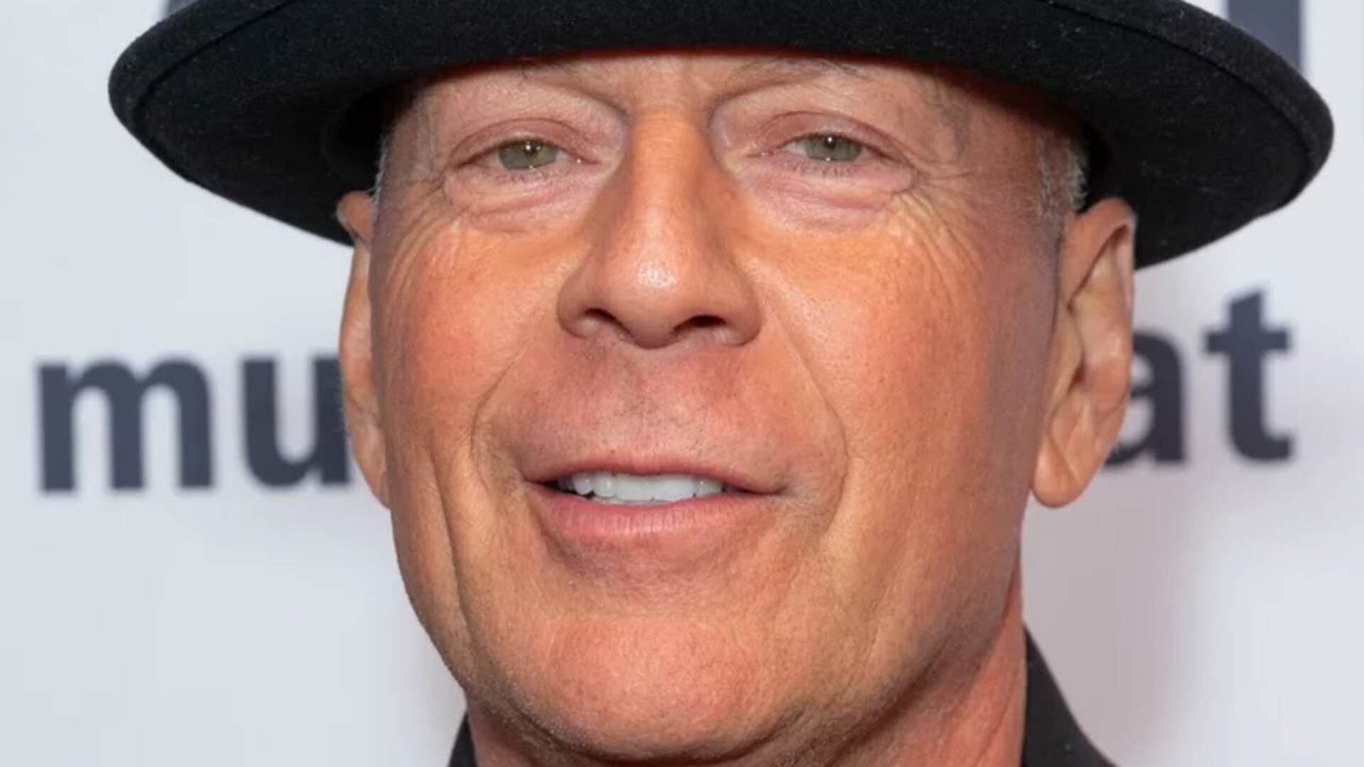 Video thumbnail for What Aphasia Does To Your Brain