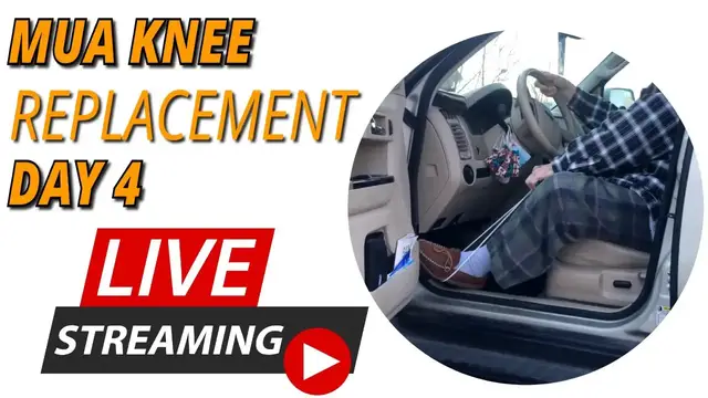 Video thumbnail for Total Knee Replacement MUA Day 4 AMAZING Improvement