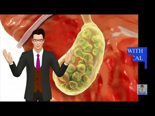 Video thumbnail for gallbladder
