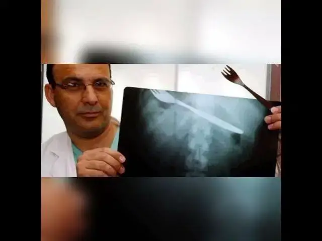 'Video thumbnail for بسبب تحدي سرط فرشيطا وخرج على راسو #دنيا_بطمة #الخراز #kissas_jarayim_bidarija'