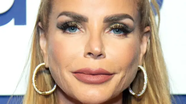 'Video thumbnail for Real Housewives Stars Who Are Almost Unrecognizable Now'