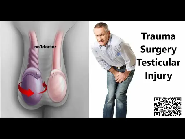 Video thumbnail for Trauma Surgery Testicular Injury #traumasurgery #Urology  #testis #testicular  #no1doctor #dratef