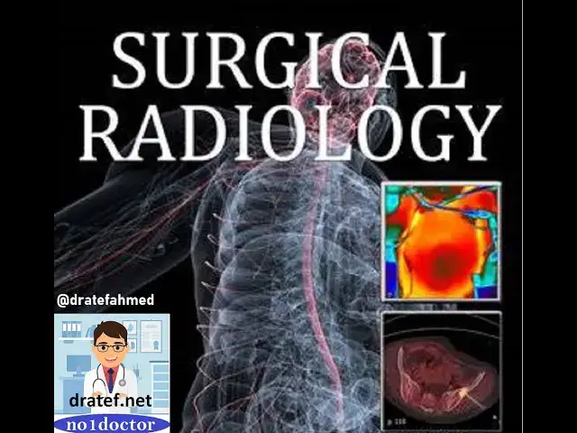 Video thumbnail for Surgical Radiology/ No1doctor/  الأشعة الجراحية/ dratef / Medical Student Lecture