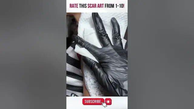 'Video thumbnail for Burn Victim Gets Transformation with New Tattoo! #Shorts #BeforeandAfter'