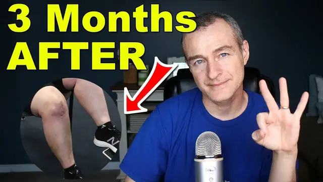 Video thumbnail for 3 Months After Total Knee Replacement