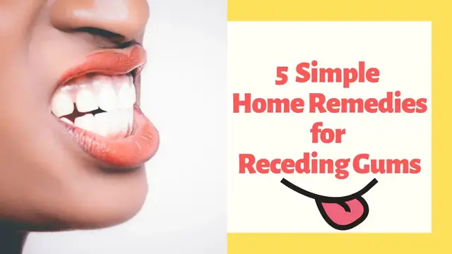 'Video thumbnail for 5 Simple Home Remedies for Receding Gums'