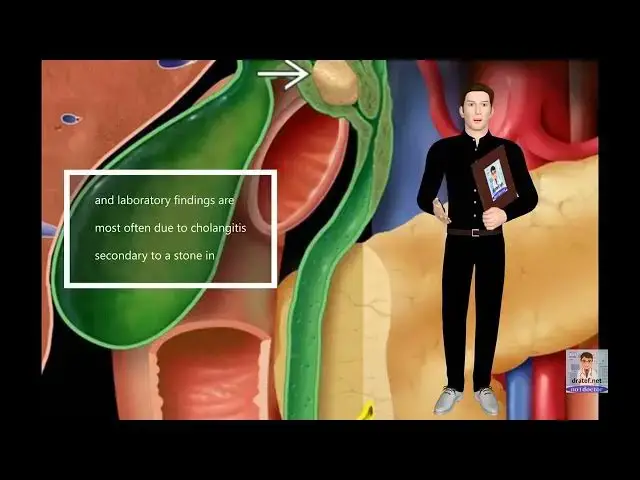 Video thumbnail for Mirizzi syndrome 1