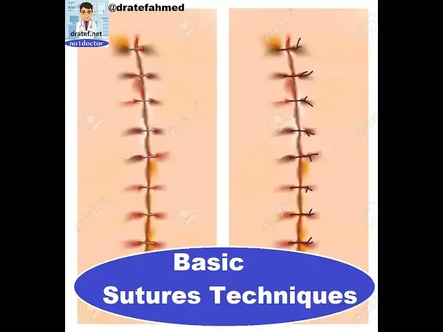 Video thumbnail for Basic Sutures Techniques / Surgical Suture Removal / Mrcs /  FRCS /USMLE  /  No1doctor / dratef