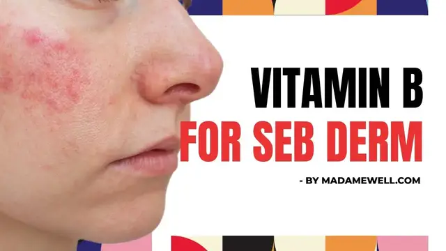 'Video thumbnail for Does Vitamin B Complex Help Control Seborrheic Dermatitis?'
