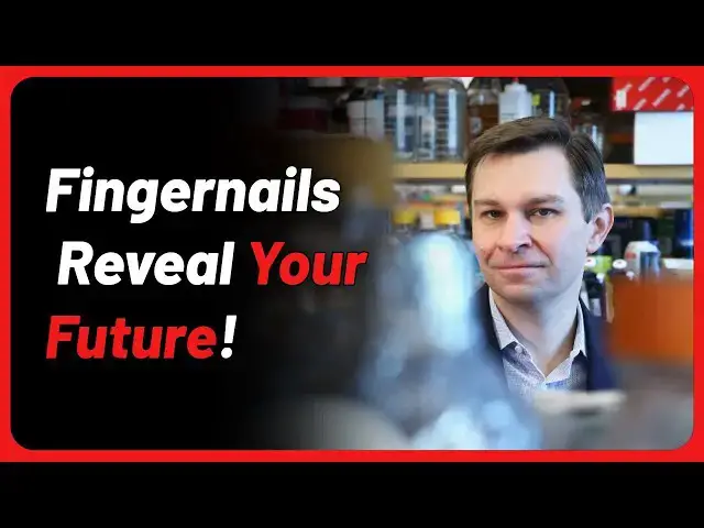 Video thumbnail for Doctor Uncovers A Telltale Sign In Your Fingernails That May Predict Your Life Expectancy
