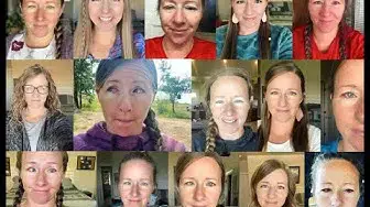 Video thumbnail for Strabismus Surgery Recovery in One Minute!