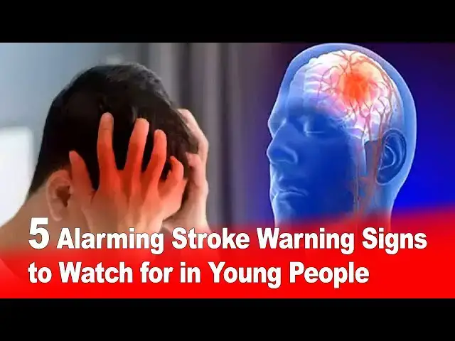 Video thumbnail for 5 Alarming Stroke Warning Signs in Young People ⚠️🧠