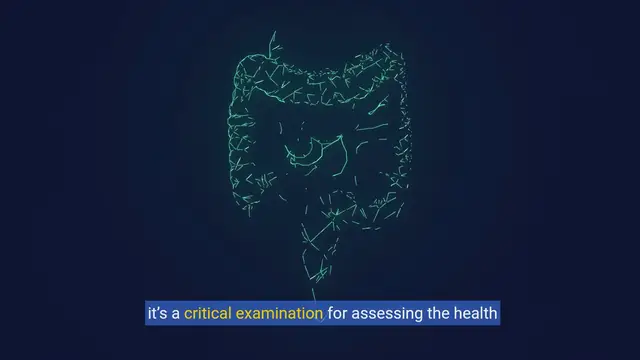 Video thumbnail for Comprehensive Strategies for Managing Colonoscopy Expenses in the Absence of Insurance Coverage