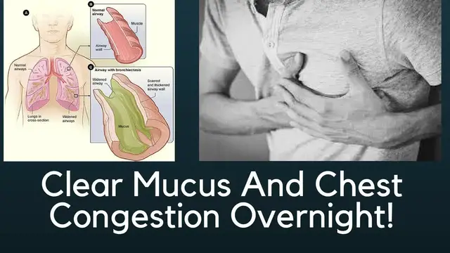 'Video thumbnail for HOW TO CLEAR CHEST CONGESTION FAST - GET RID OF MUCUS IN THE THROAT NATURALLY'