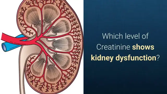 'Video thumbnail for What Creatinine Level Indicates kidney Disease [MUST SEE]'