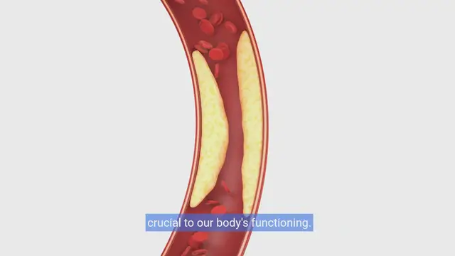Video thumbnail for Unlock Heart Health:Natural Ways to Lower Cholesterol